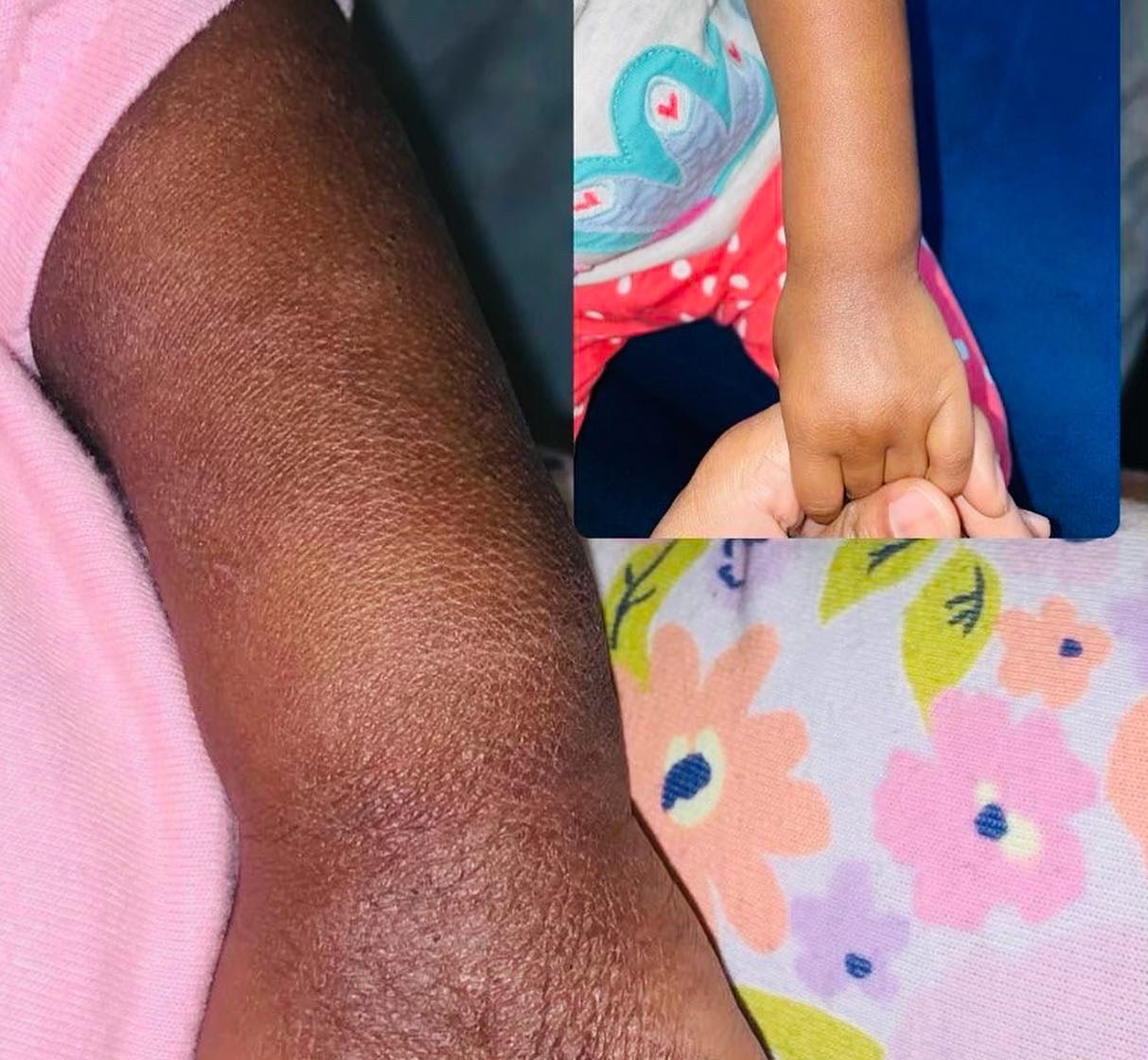 Soothing Eczema Body Butter natural skincare by Urban Serenité Apothecary