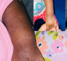 Soothing Eczema Body Butter natural skincare by Urban Serenité Apothecary